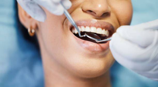 Best Emergency Treatment for Dental Infections or Abscesses in Pinole, CA